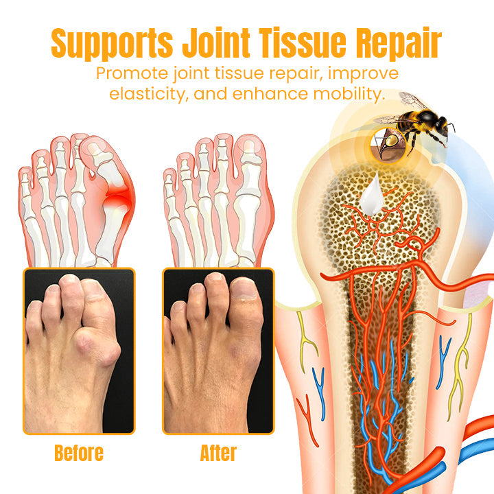 Ceoerty™ MelittinPRO Bee Venom Joint Repair Cream - 👨⚕️ American Orthopaedic Association (AOA) Approved
