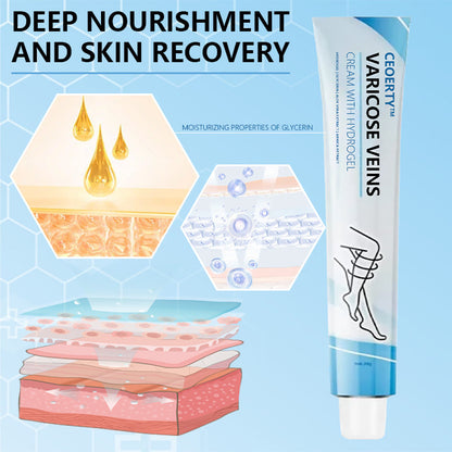 Ceoerty™ Varicose Veins Cream with Hydrogel