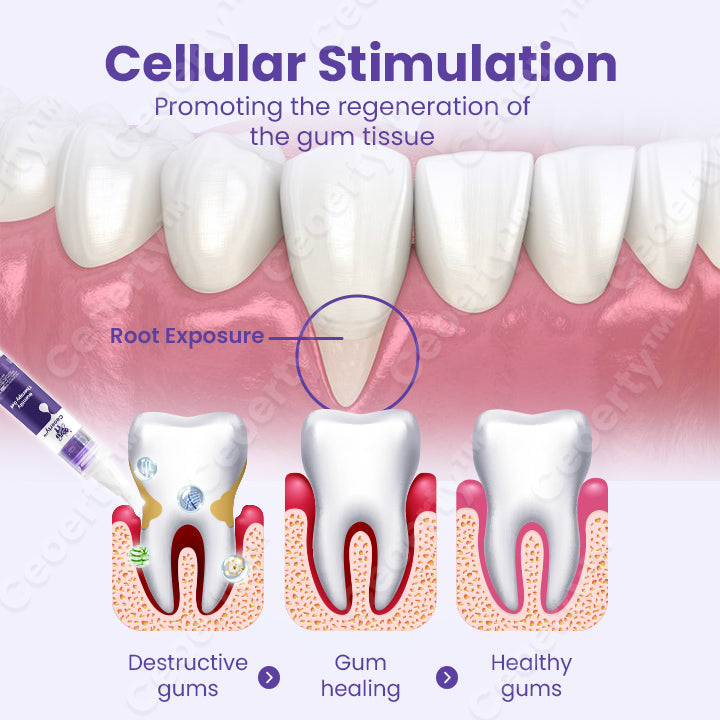 Ceoerty™ Gumtify Therapy Gel