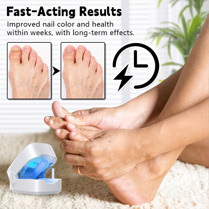 Biancat™ Nail Fungal Infection Repair Device