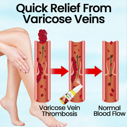 Ceoerty™ VeinMist Varicose Vein Spray