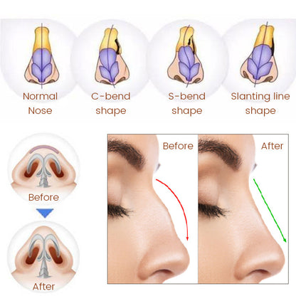 Ceoerty™ NoseTique Rhinoplasty Serum