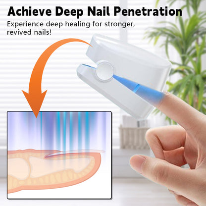 Biancat™ Nail Fungal Infection Repair Device