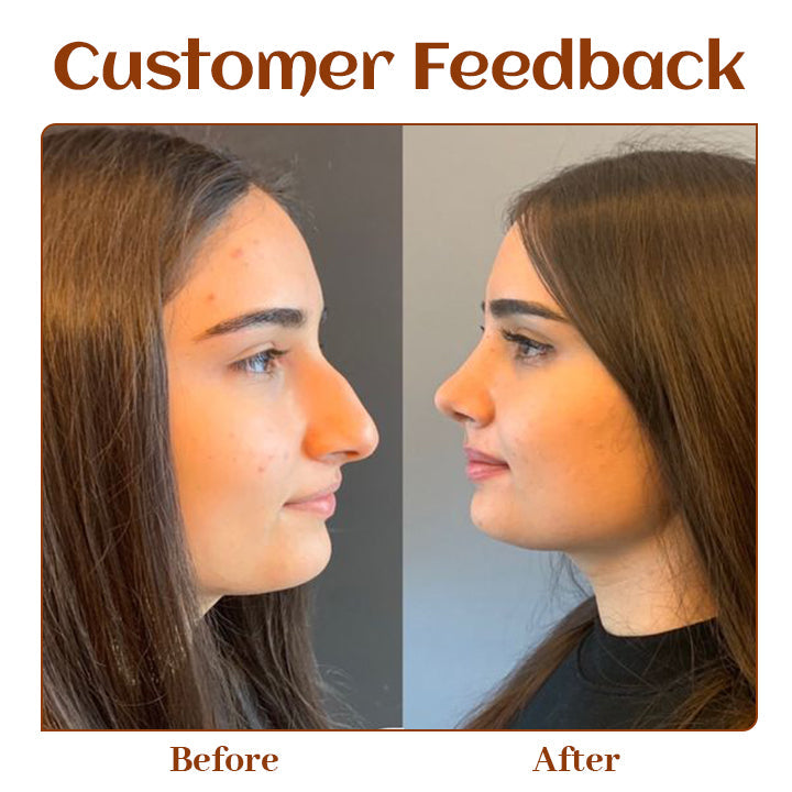 Ceoerty™ NoseTique Rhinoplasty Serum