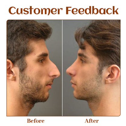 Ceoerty™ NoseTique Rhinoplasty Serum