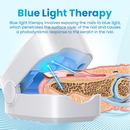 Ceoerty™ Antifungal Light Therapy Toenail Device