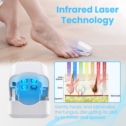 Ceoerty™ FungiGuard Nail Laser Therapy Device