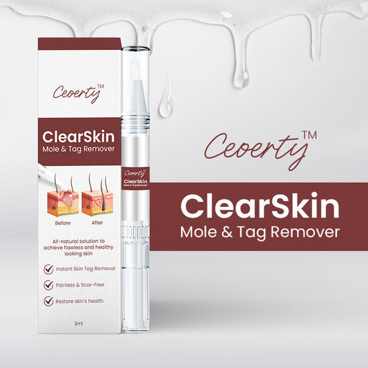 Ceoerty™ ClearSkin Mole & Tag Remover