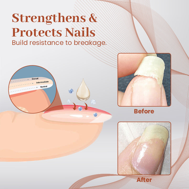 Ceoerty™ PROStrength Ultimate Nail Repair Serum